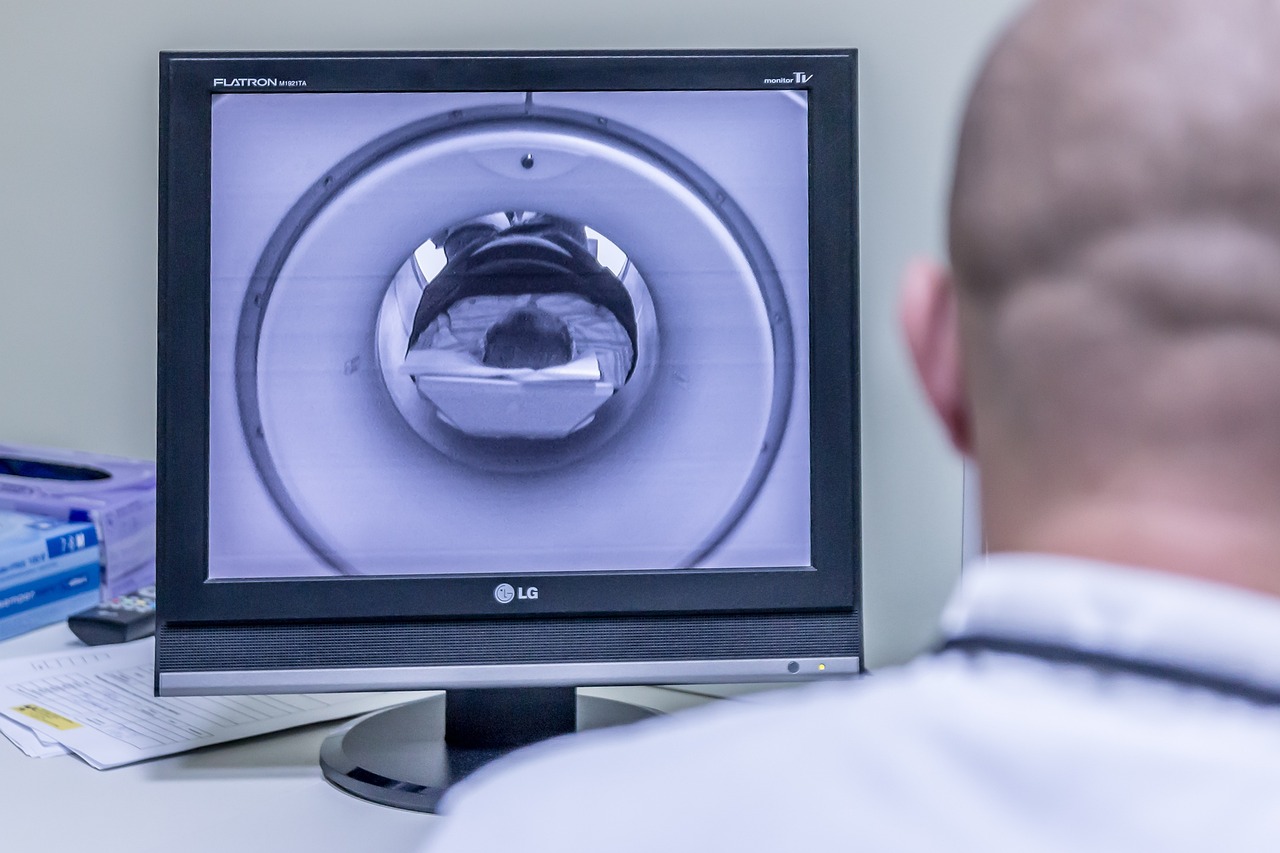 Widok od tyłu na lekarza, który ogląda na komputerze badanie rezonansu magnetycznego w Częstochowie